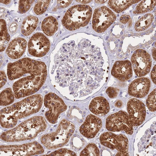 CRYGN Antibody in Immunohistochemistry (Paraffin) (IHC (P))
