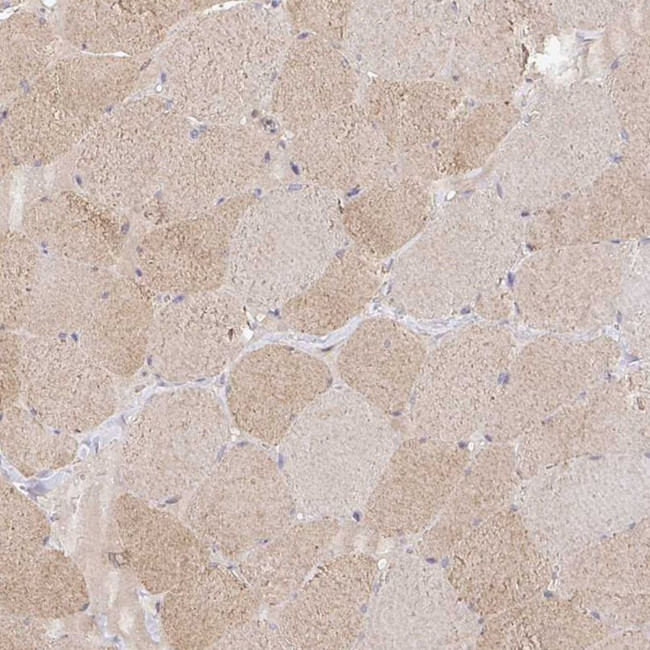 ISLR Antibody in Immunohistochemistry (IHC)
