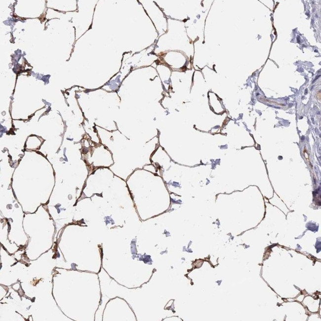 TUSC5 Antibody in Immunohistochemistry (Paraffin) (IHC (P))