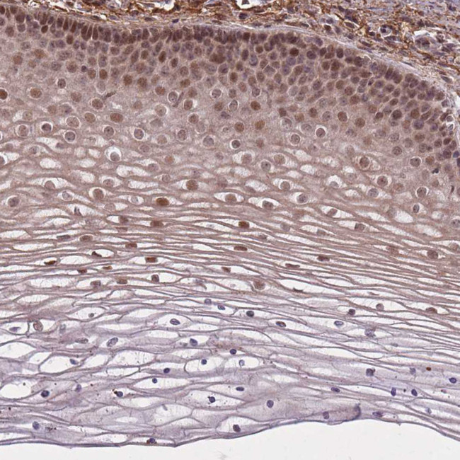 ZNF391 Antibody in Immunohistochemistry (Paraffin) (IHC (P))