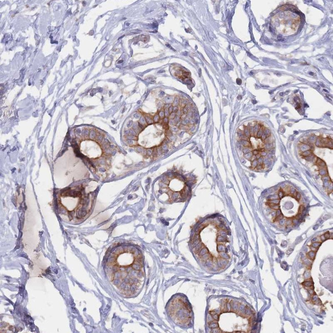 CCDC48 Antibody in Immunohistochemistry (Paraffin) (IHC (P))