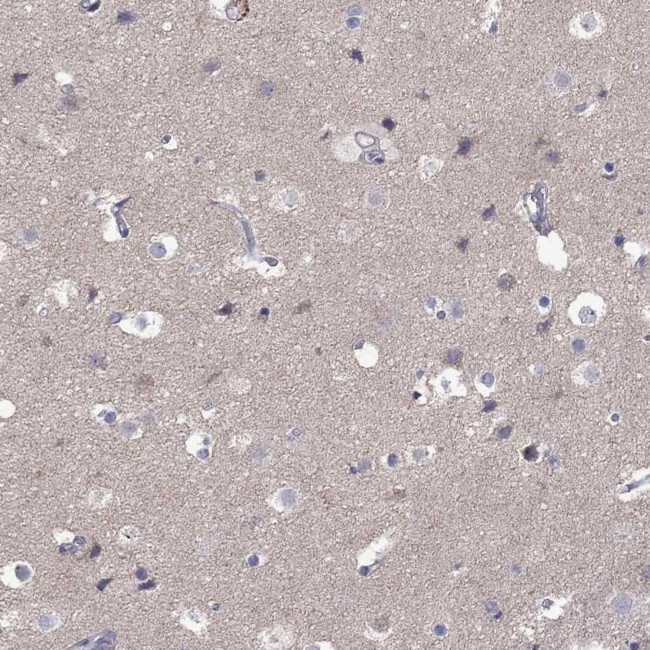 RTP5 Antibody in Immunohistochemistry (Paraffin) (IHC (P))