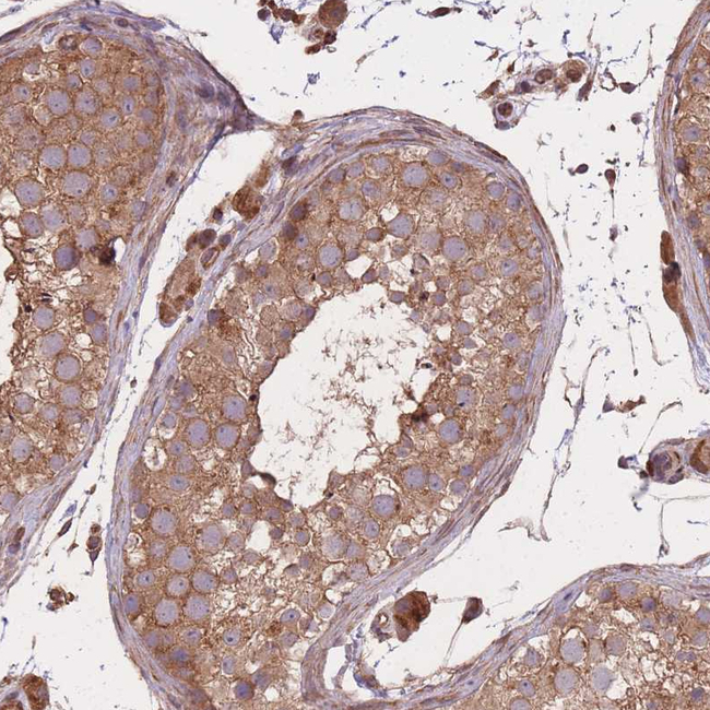 C10orf76 Antibody in Immunohistochemistry (Paraffin) (IHC (P))