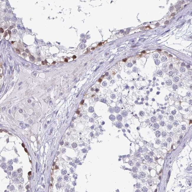 PLAC1L Antibody in Immunohistochemistry (Paraffin) (IHC (P))