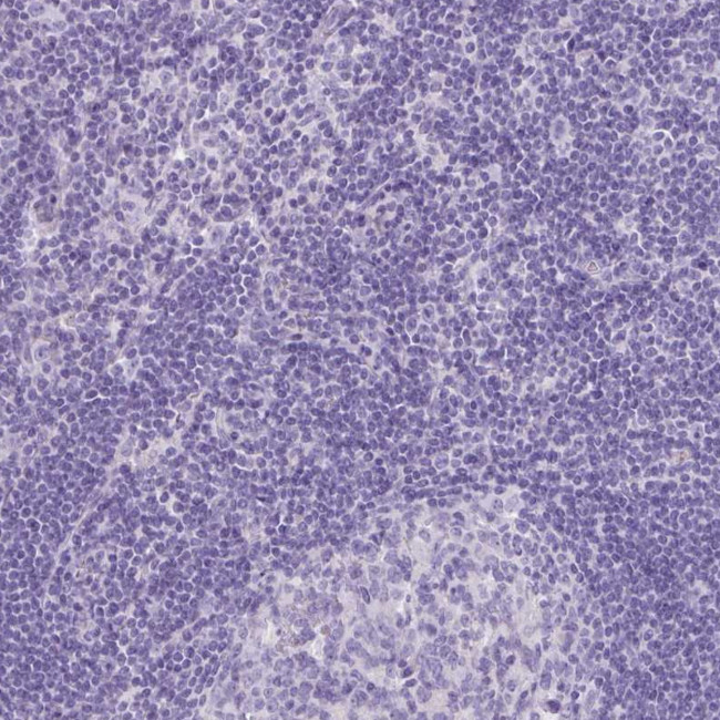 CYSTM1 Antibody in Immunohistochemistry (Paraffin) (IHC (P))