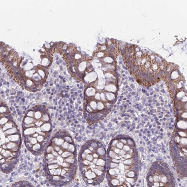 RNF170 Antibody in Immunohistochemistry (IHC)