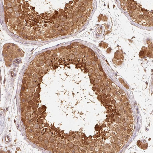 RRAS2 Antibody in Immunohistochemistry (Paraffin) (IHC (P))