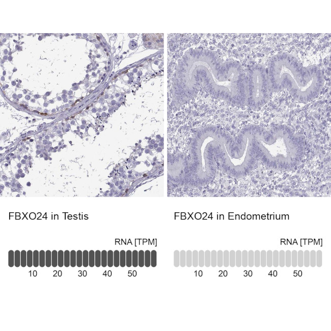 FBXO24 Antibody in Immunohistochemistry (IHC)