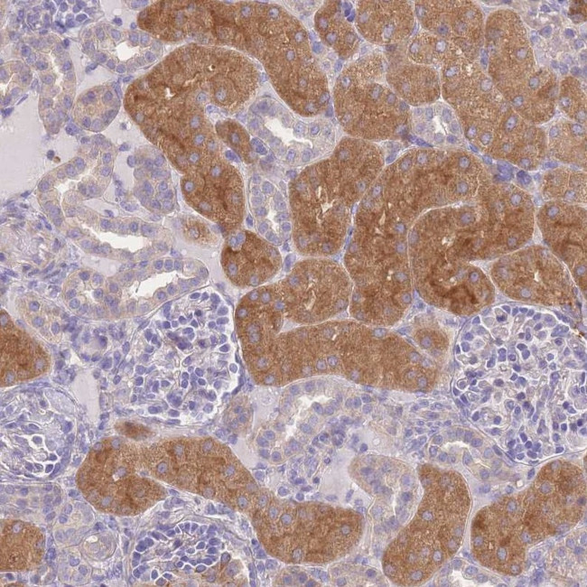 OR5T1 Antibody in Immunohistochemistry (IHC)