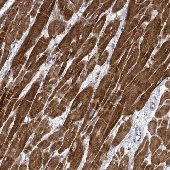 FAM47B Antibody in Immunohistochemistry (Paraffin) (IHC (P))