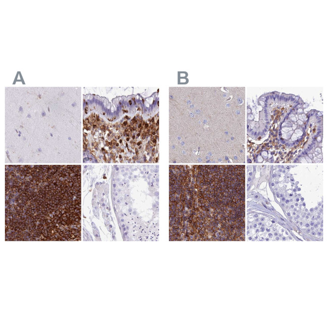 PPP1R18 Antibody in Immunohistochemistry (IHC)