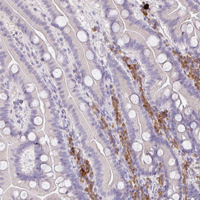 ZNF215 Antibody in Immunohistochemistry (Paraffin) (IHC (P))