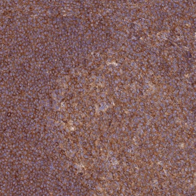 GGA1 Antibody in Immunohistochemistry (Paraffin) (IHC (P))