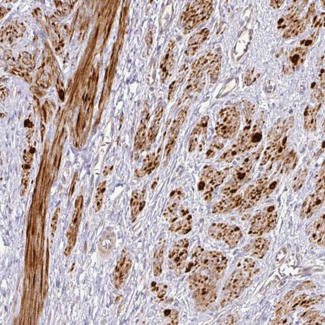 TARM1 Antibody in Immunohistochemistry (Paraffin) (IHC (P))