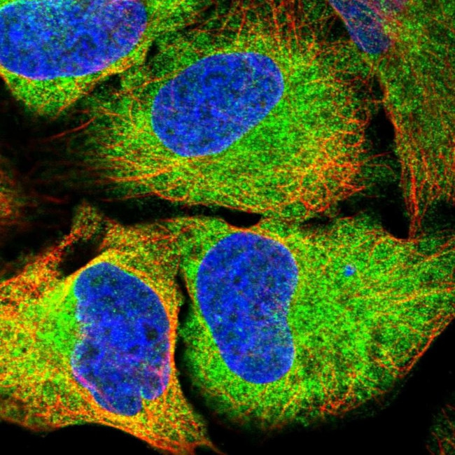 EI24 Antibody in Immunocytochemistry (ICC/IF)