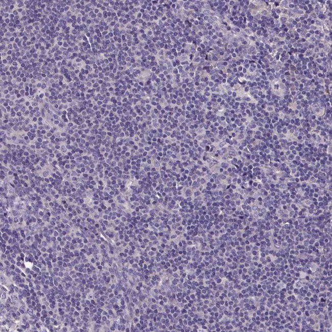 LMOD2 Antibody in Immunohistochemistry (Paraffin) (IHC (P))