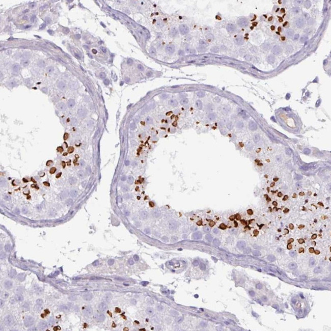 SPESP1 Antibody in Immunohistochemistry (Paraffin) (IHC (P))