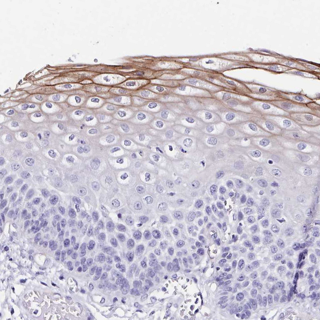 TMPRSS11E Antibody in Immunohistochemistry (Paraffin) (IHC (P))