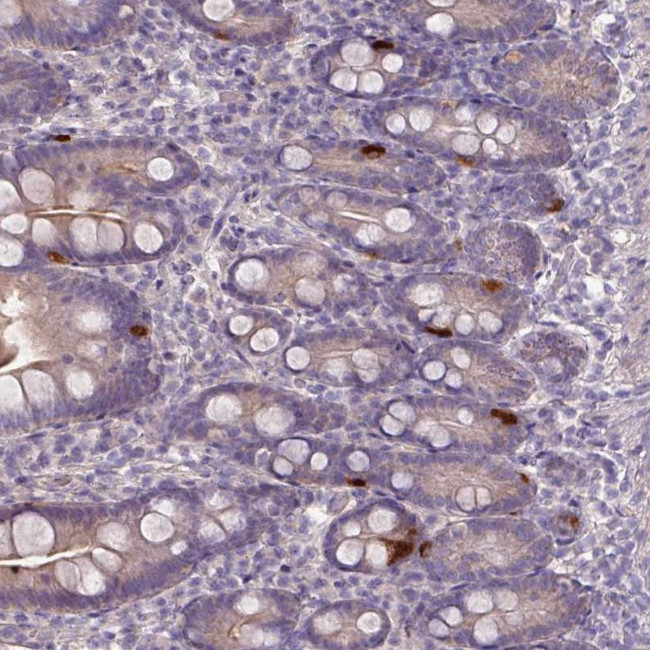 C2orf7 Antibody in Immunohistochemistry (Paraffin) (IHC (P))