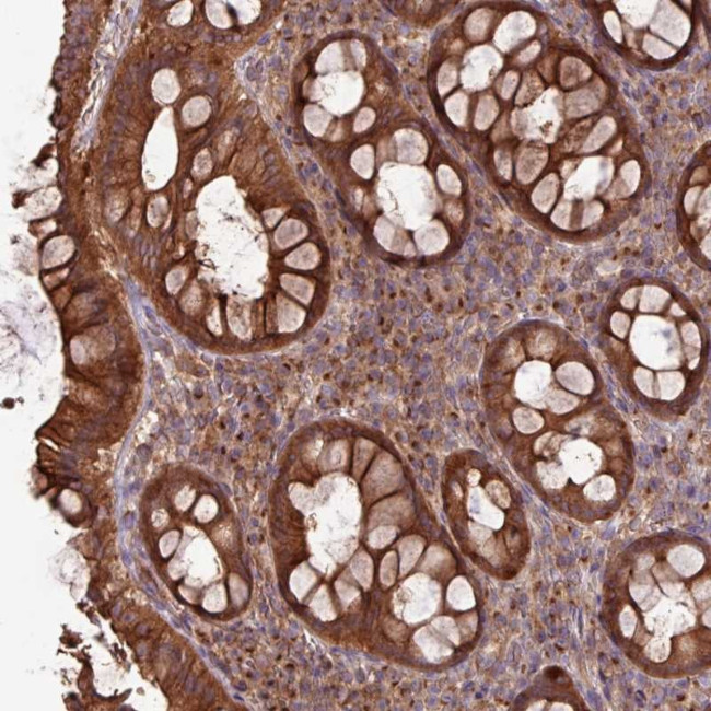 RAB19 Antibody in Immunohistochemistry (Paraffin) (IHC (P))