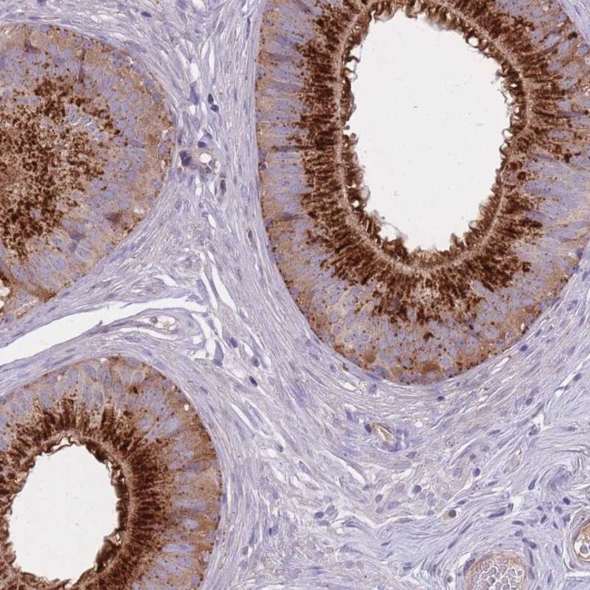 KIAA1211L Antibody in Immunohistochemistry (IHC)