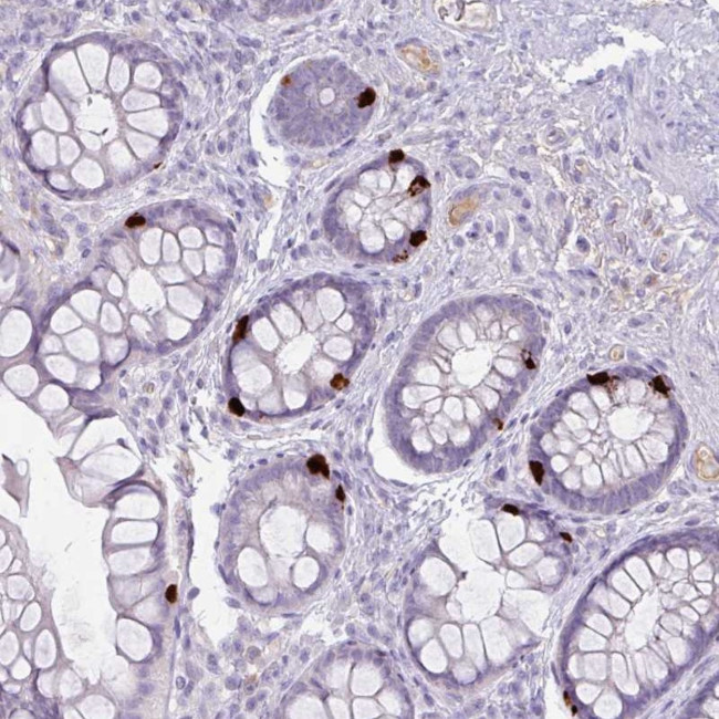 OR6C6 Antibody in Immunohistochemistry (Paraffin) (IHC (P))