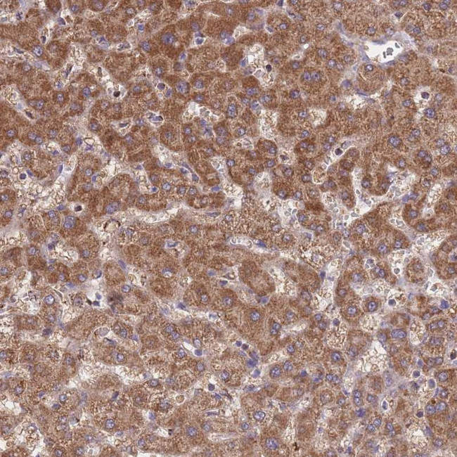 ST3GAL3 Antibody in Immunohistochemistry (Paraffin) (IHC (P))