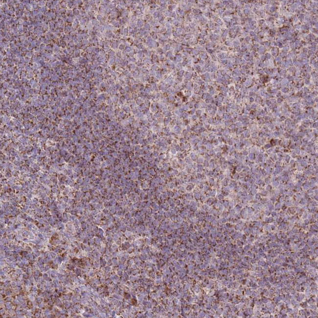 LIN7C Antibody in Immunohistochemistry (Paraffin) (IHC (P))