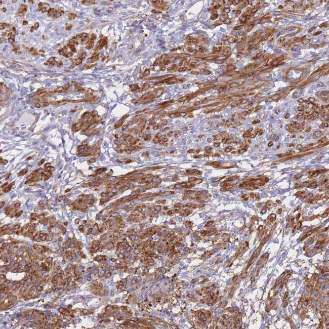 TIAF1 Antibody in Immunohistochemistry (Paraffin) (IHC (P))