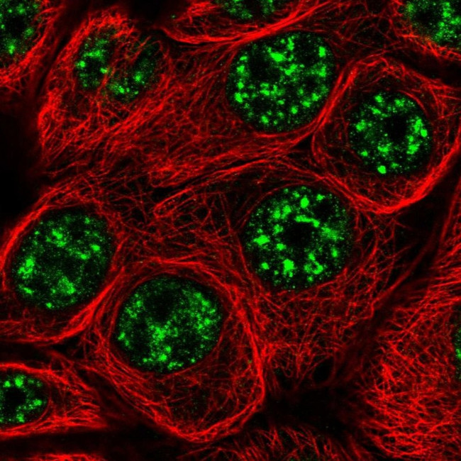 C6orf52 Antibody in Immunocytochemistry (ICC/IF)