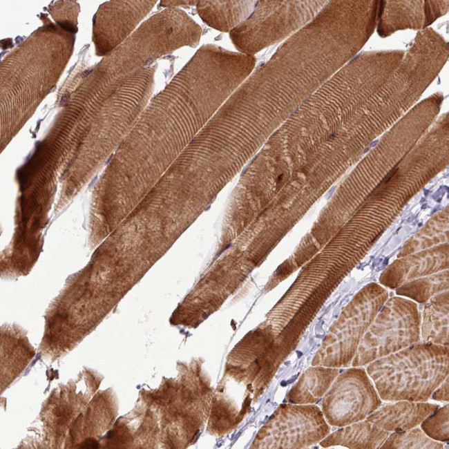 ART1 Antibody in Immunohistochemistry (Paraffin) (IHC (P))