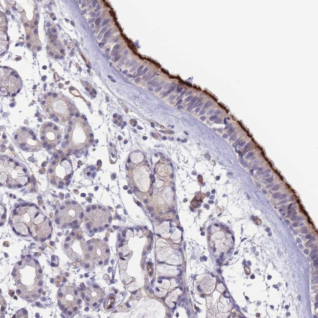 NDUFAF5 Antibody in Immunohistochemistry (Paraffin) (IHC (P))