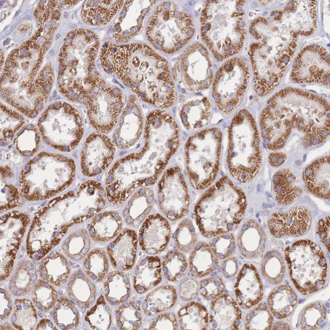 KIF16B Antibody in Immunohistochemistry (Paraffin) (IHC (P))