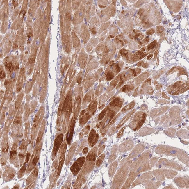TMOD1 Antibody in Immunohistochemistry (Paraffin) (IHC (P))