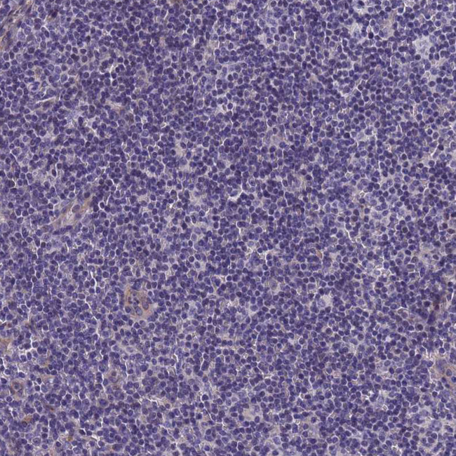 FAM83F Antibody in Immunohistochemistry (Paraffin) (IHC (P))