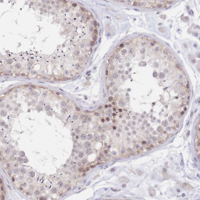 PYHIN1 Antibody in Immunohistochemistry (Paraffin) (IHC (P))