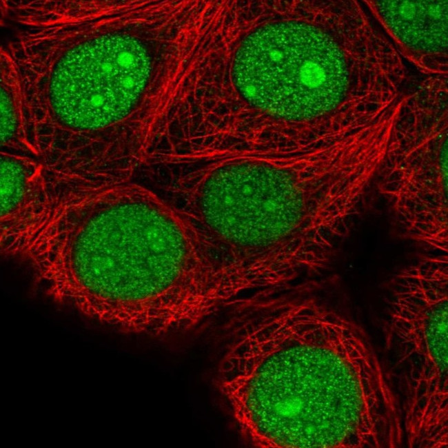 SPC24 Antibody in Immunocytochemistry (ICC/IF)