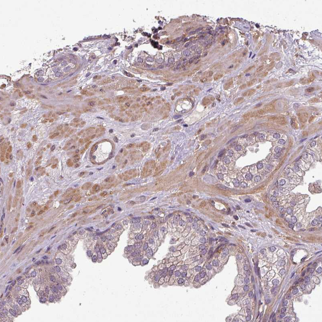 SH3BGRL Antibody in Immunohistochemistry (Paraffin) (IHC (P))