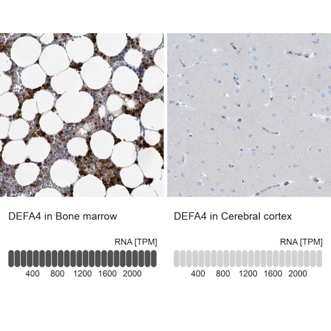 DEFA4 Antibody in Immunohistochemistry (IHC)