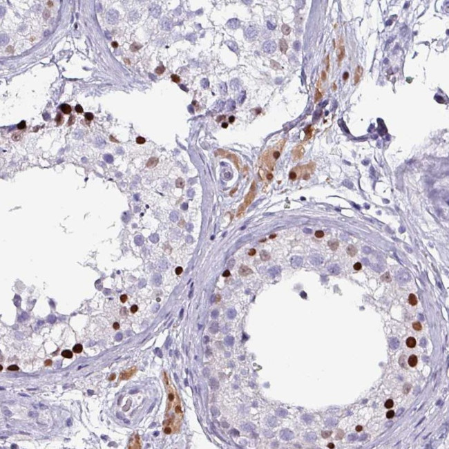 ZNF816-ZNF321P Antibody in Immunohistochemistry (Paraffin) (IHC (P))