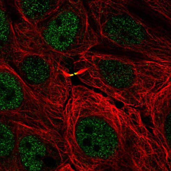 TMEM8A Antibody in Immunocytochemistry (ICC/IF)