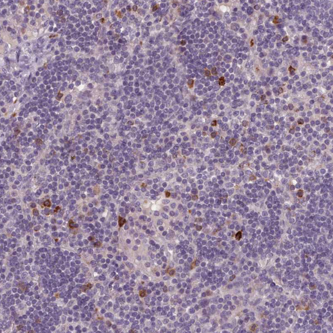 LAPTM5 Antibody in Immunohistochemistry (Paraffin) (IHC (P))