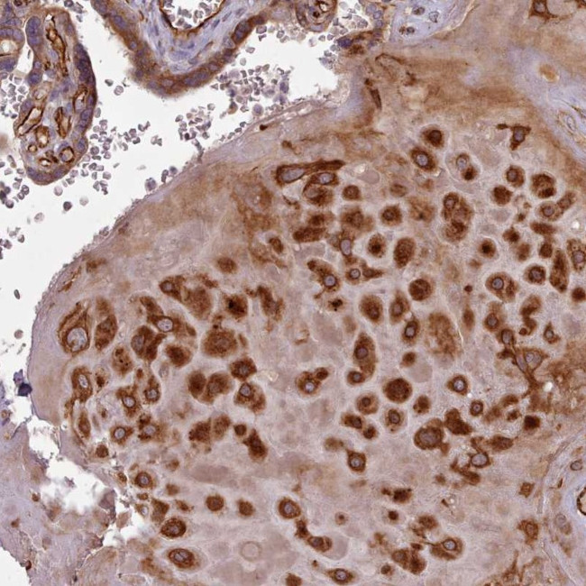 GBGT1 Antibody in Immunohistochemistry (Paraffin) (IHC (P))
