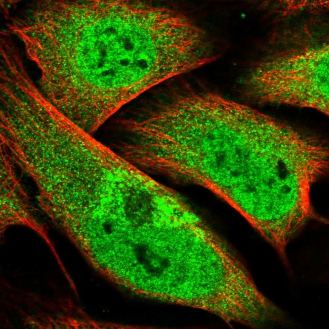 ZMYM4 Antibody in Immunocytochemistry (ICC/IF)