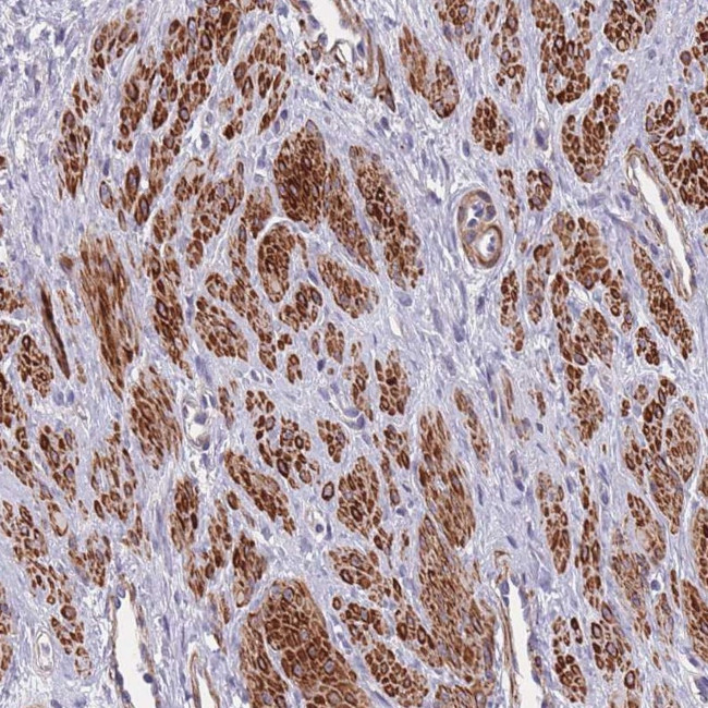 TOMM40L Antibody in Immunohistochemistry (Paraffin) (IHC (P))