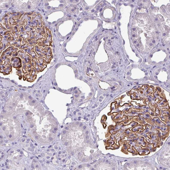 KIAA0317 Antibody in Immunohistochemistry (Paraffin) (IHC (P))