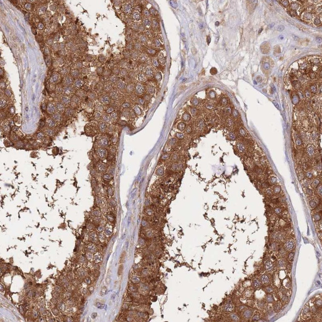 SLC4A9 Antibody in Immunohistochemistry (Paraffin) (IHC (P))