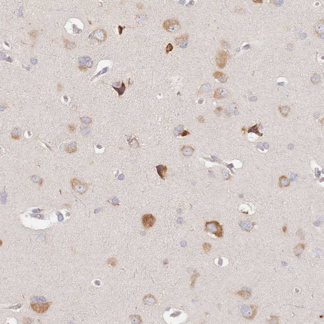 SLC35F3 Antibody in Immunohistochemistry (Paraffin) (IHC (P))