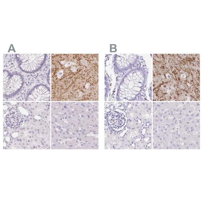 Synaptoporin Antibody in Immunohistochemistry (IHC)