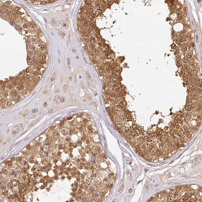 NDUFB2 Antibody in Immunohistochemistry (Paraffin) (IHC (P))